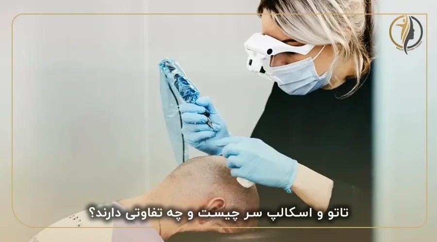 تاتو و اسکالپ سر چیست و چه تفاوتی دارند؟