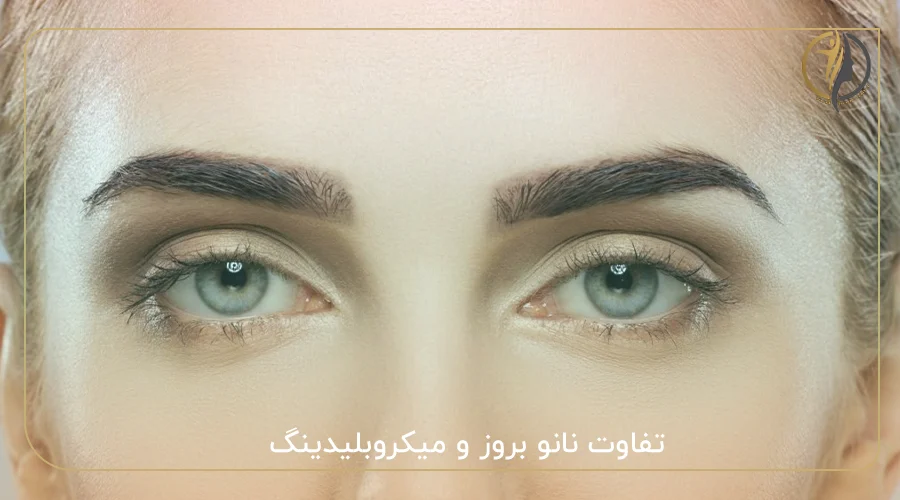 تفاوت نانو بروز و میکروبلیدینگ