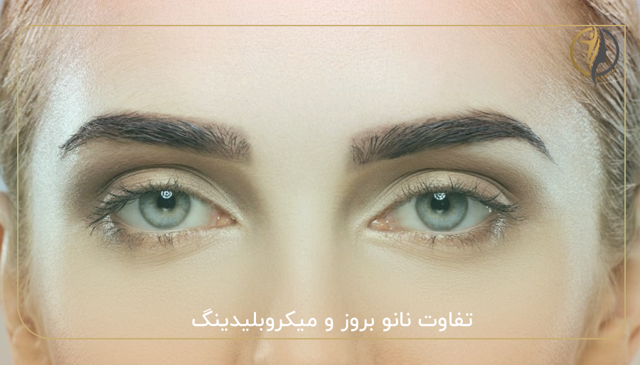 تفاوت نانو بروز و میکروبلیدینگ