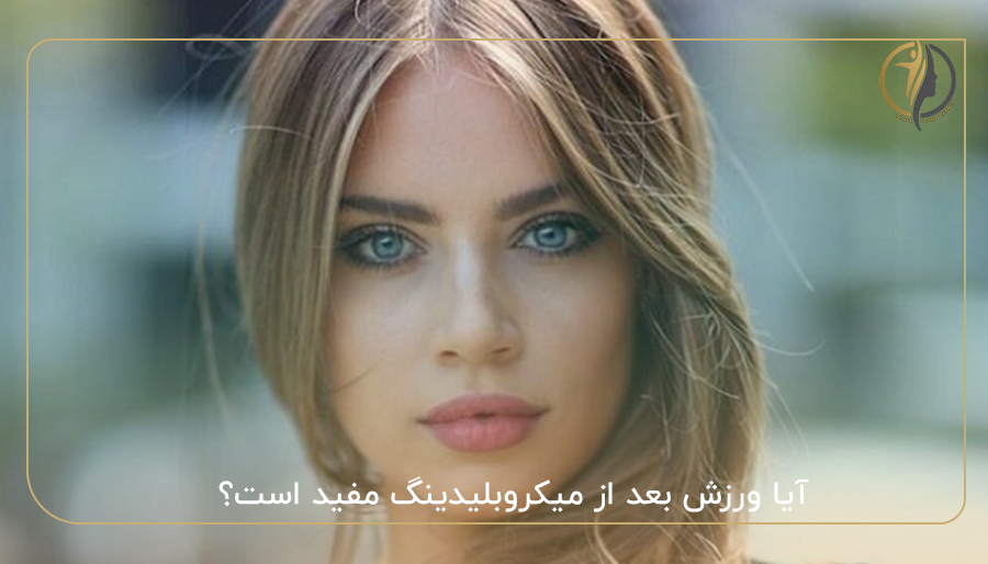 آیا ورزش بعد از میکروبلیدینگ مفید است؟