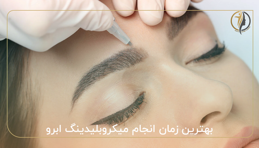 بهترین زمان انجام میکروبلیدینگ ابرو