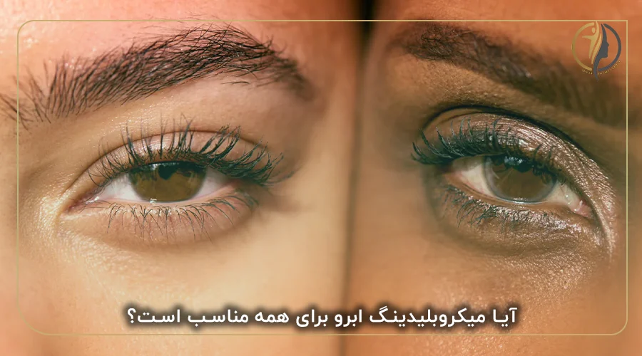 آیا میکروبلیدینگ ابرو برای همه مناسب است؟