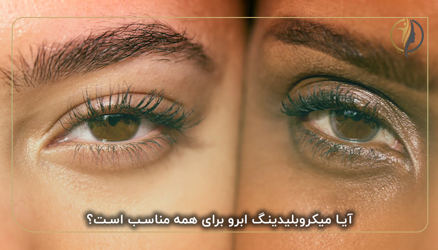 آیا میکروبلیدینگ ابرو برای همه مناسب است؟
