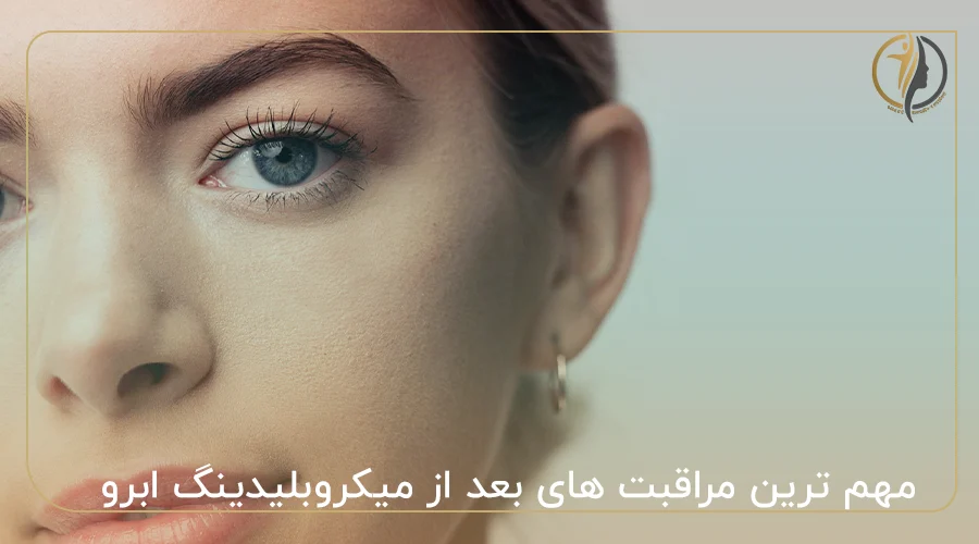 مهم ترین مراقبت های بعد از میکروبلیدینگ ابرو