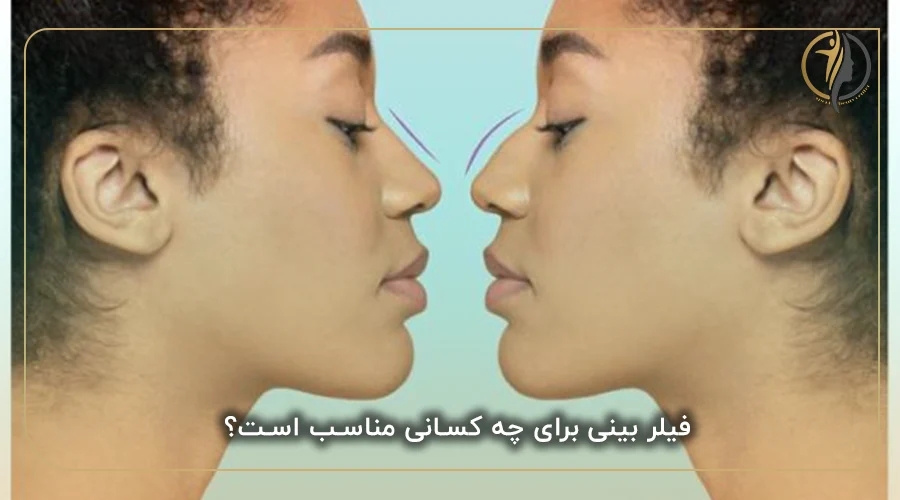 فیلر بینی برای چه کسانی مناسب است؟