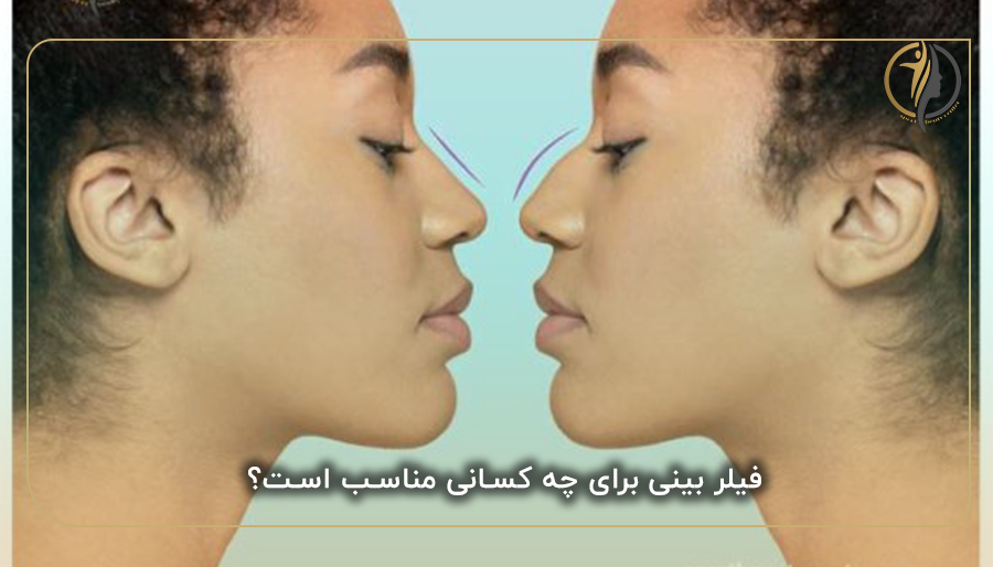 فیلر بینی برای چه کسانی مناسب است؟