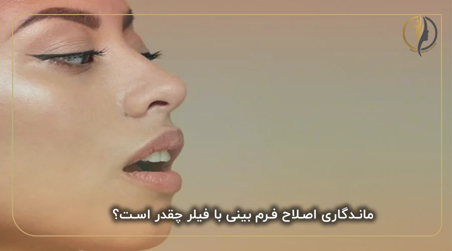 ماندگاری اصلاح فرم بینی با فیلر چقدر است؟