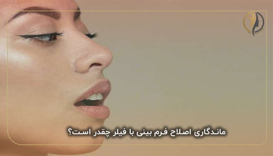 ماندگاری اصلاح فرم بینی با فیلر چقدر است؟