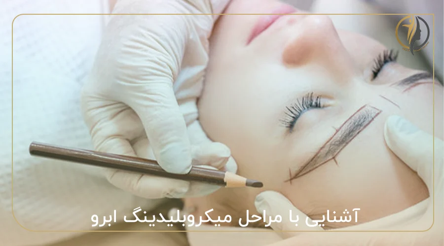 آشنایی با مراحل میکروبلیدینگ ابرو