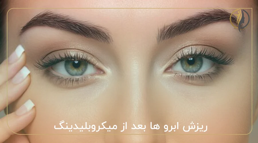 ریزش ابرو ها بعد از میکروبلیدینگ