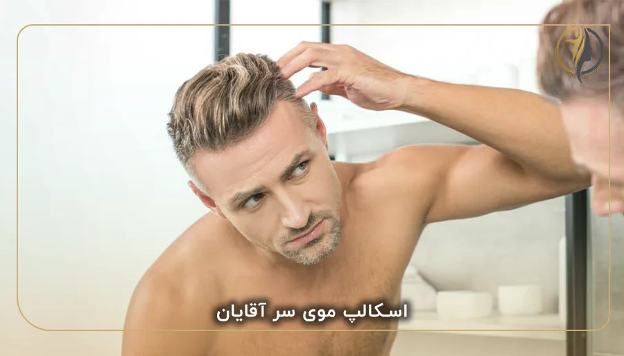 اسکالپ موی سر اقایان