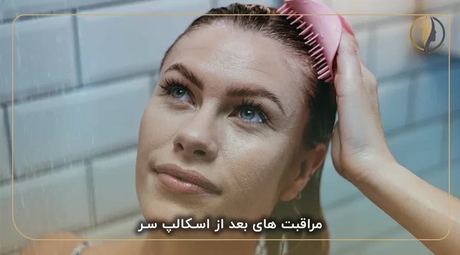 مراقبت های بعد از اسکالپ سر