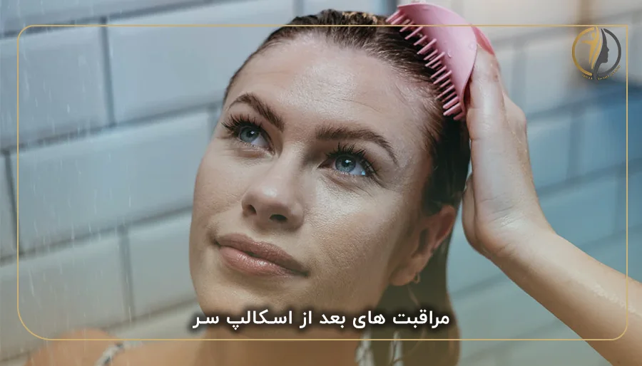 مراقبت های بعد از اسکالپ سر