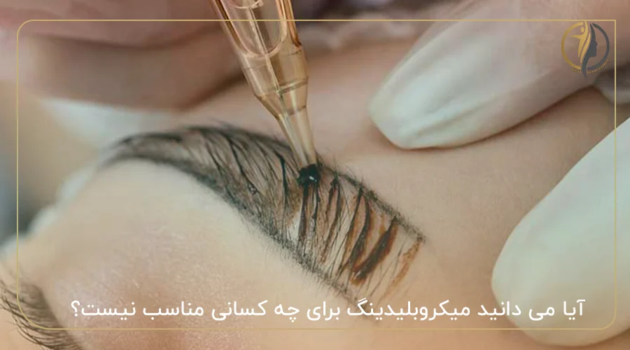 آیا می دانید میکروبلیدینگ برای چه کسانی مناسب نیست؟