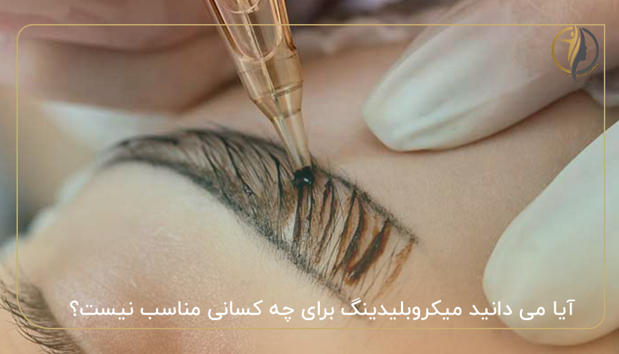 آیا می دانید میکروبلیدینگ برای چه کسانی مناسب نیست؟