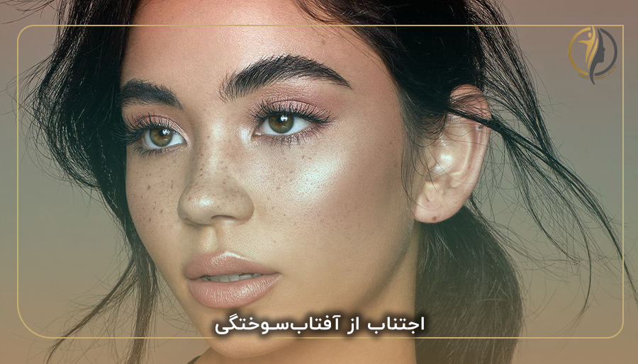 اجتناب از آفتاب‌سوختگی