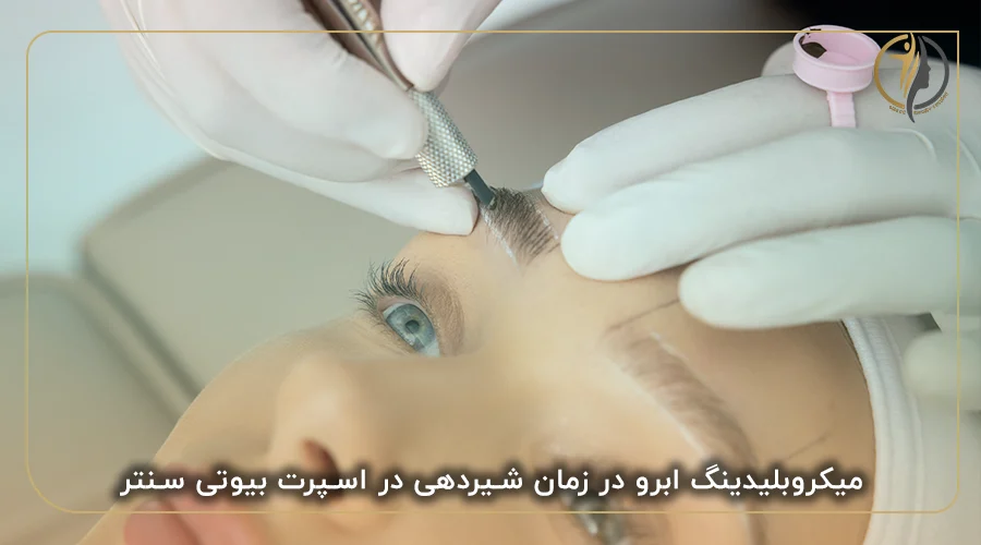 میکروبلیدینگ ابرو در زمان شیردهی در اسپرت بیوتی سنتر