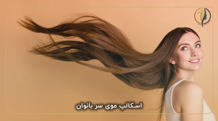 اسکالپ موی سر بانوان