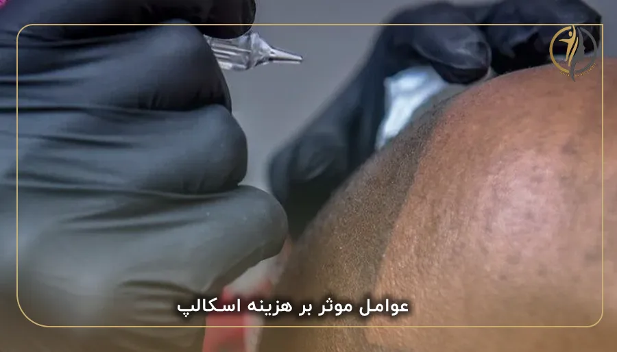 عوامل موثر بر هزینه اسکالپ