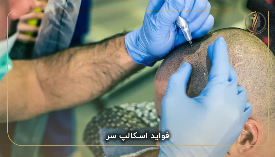 فواید اسکالپ سر