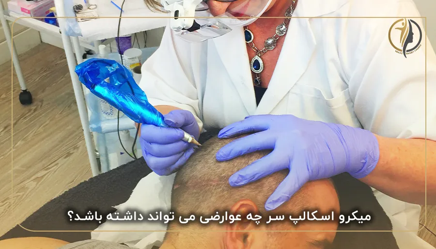 میکرو اسکالپ سر چه عوارضی می تواند داشته باشد؟