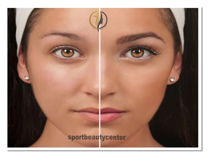 میکروبلیدینگ ابرو چیست