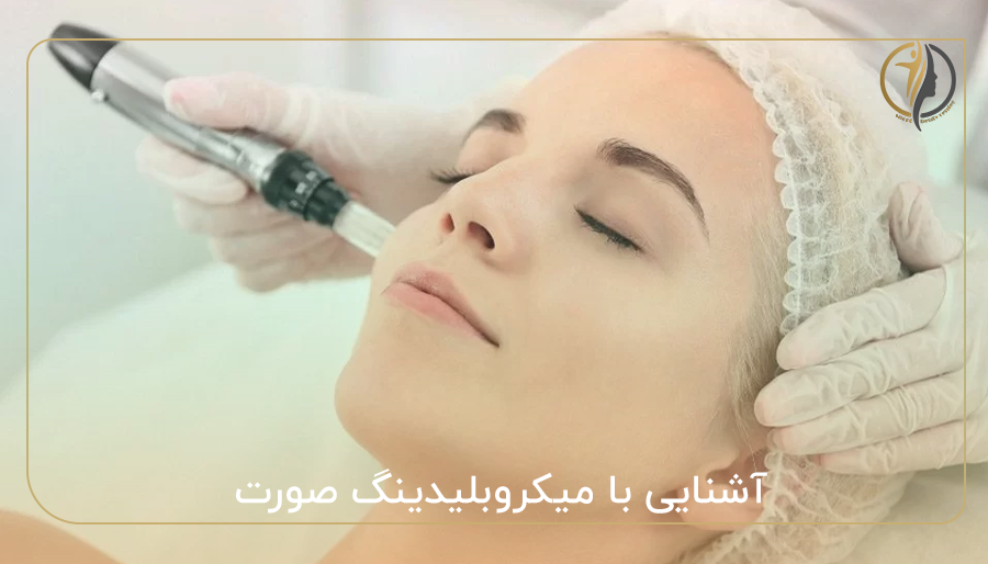 آشنایی با میکروبلیدینگ صورت