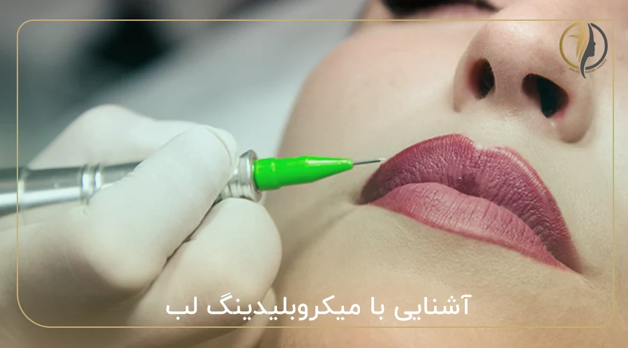 آشنایی با میکروبلیدینگ لب
