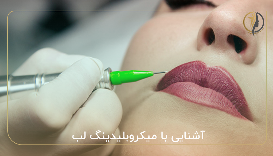 آشنایی با میکروبلیدینگ لب