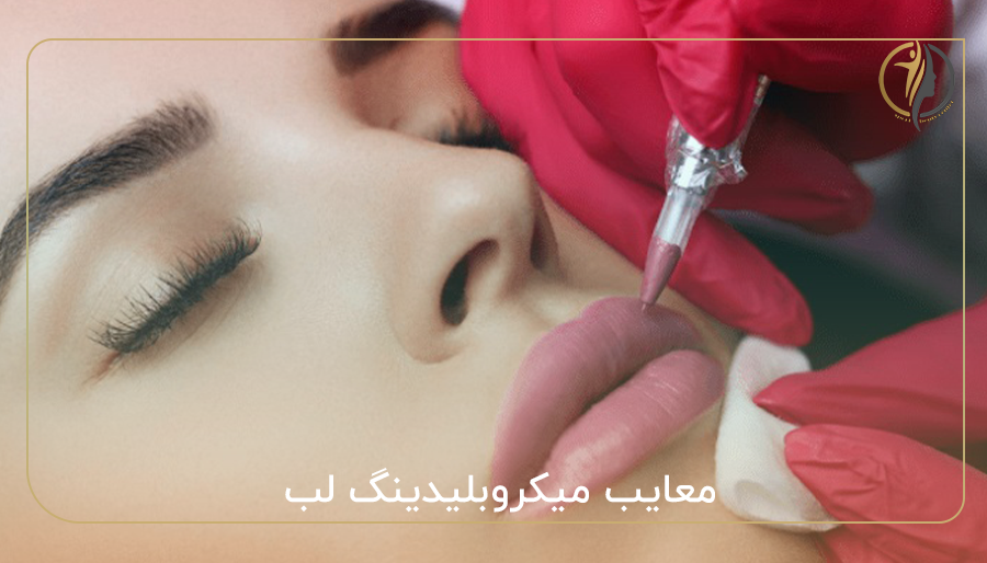 معایب میکروبلیدینگ لب