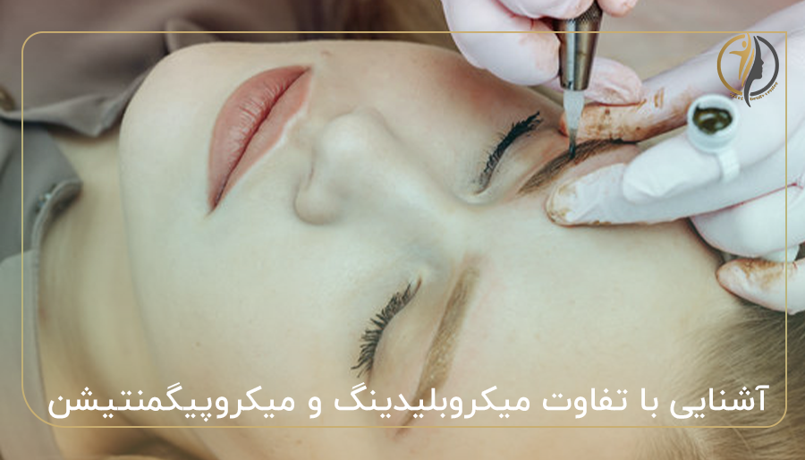 آشنایی با تفاوت میکروبلیدینگ و میکروپیگمنتیشن