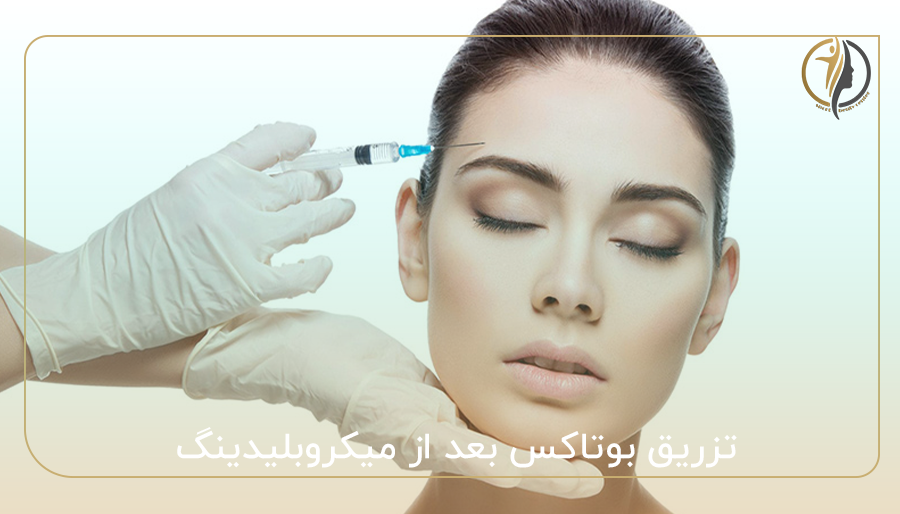تزریق بوتاکس بعد از میکروبلیدینگ
