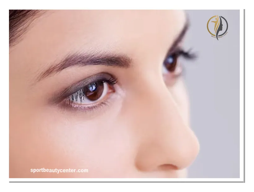 میکروبلیدینگ مژه