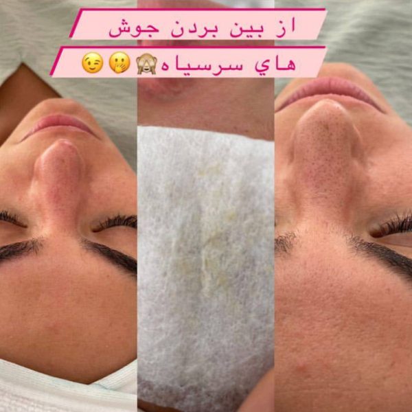facial