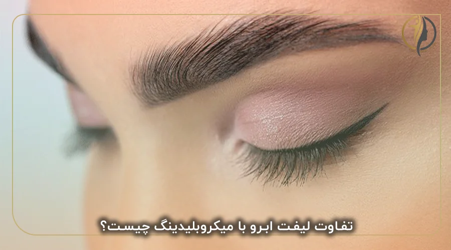 تفاوت لیفت ابرو با میکروبلیدینگ چیست؟