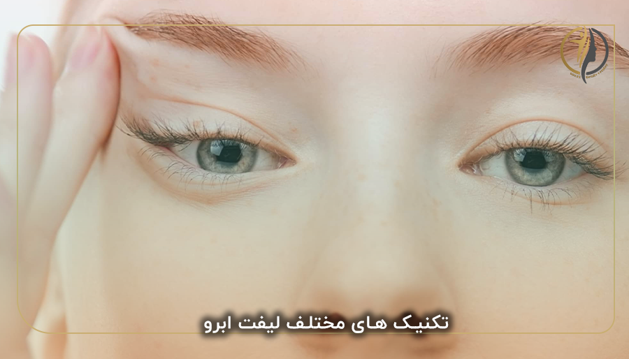 تکنیک های مختلف لیفت ابرو