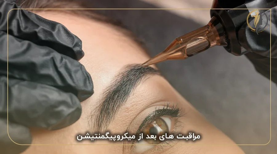 مراقبت های بعد از میکروپیگمنتیشن ابرو