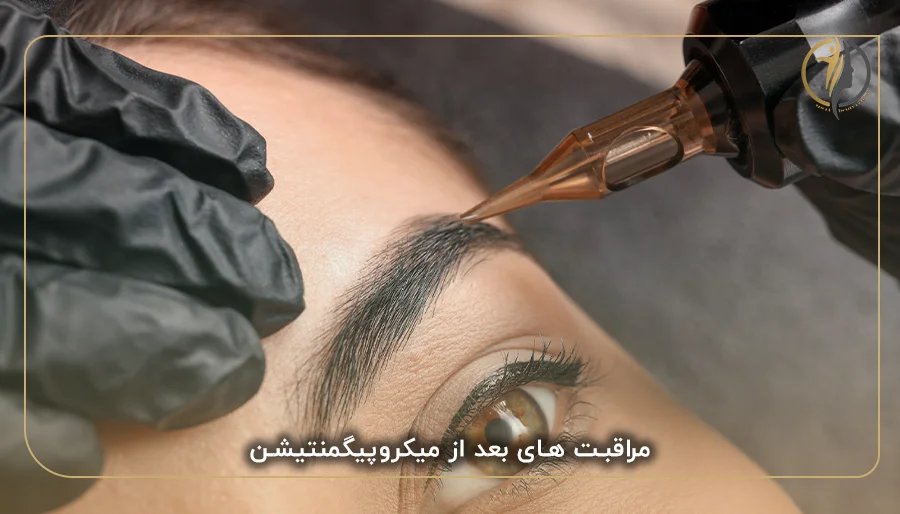 مراقبت های بعد از میکروپیگمنتیشن ابرو