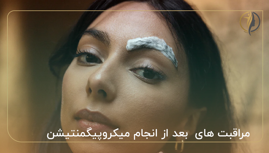 مراقبت ها‌ی بعد از انجام میکروپیگمنتیشن در روز اول – چهارم
