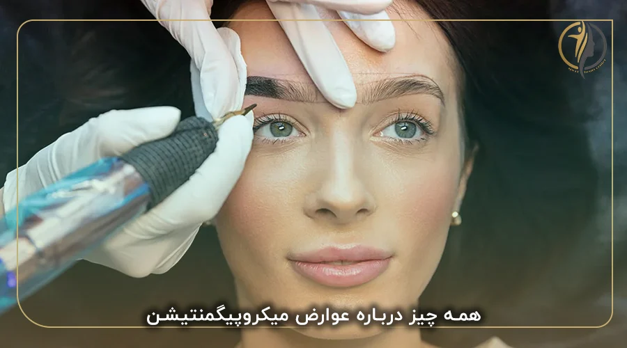 همه چیز درباره عوارض میکروپیگمنتیشن