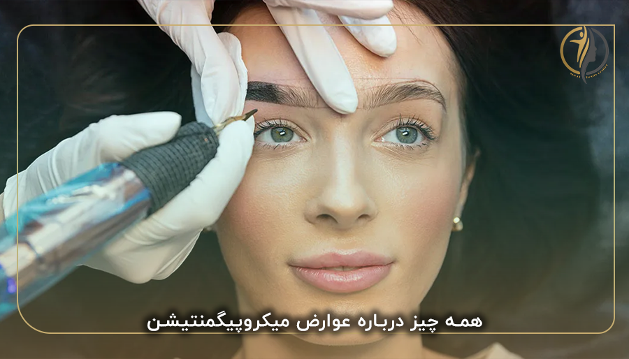 همه چیز درباره عوارض میکروپیگمنتیشن