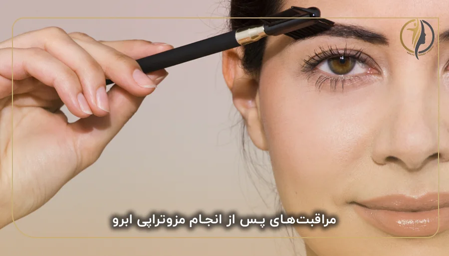 مراقبت‌های پس از انجام مزوتراپی ابرو