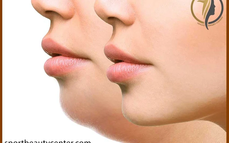 از کجا بفهمیم زاویه فک داریم؟ راهنمای ساده و سریع