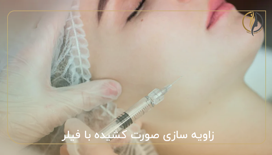 زاویه سازی صورت کشیده با فیلر