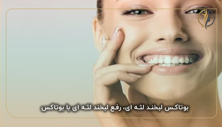 بوتاکس لبخند لثه ای، رفع لبخند لثه ای با بوتاکس