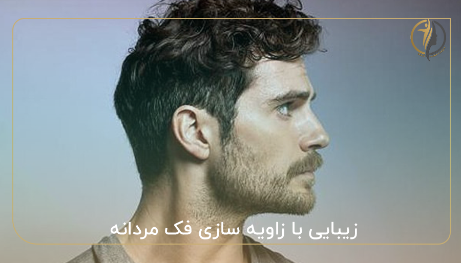 زیبایی با زاویه سازی فک مردانه