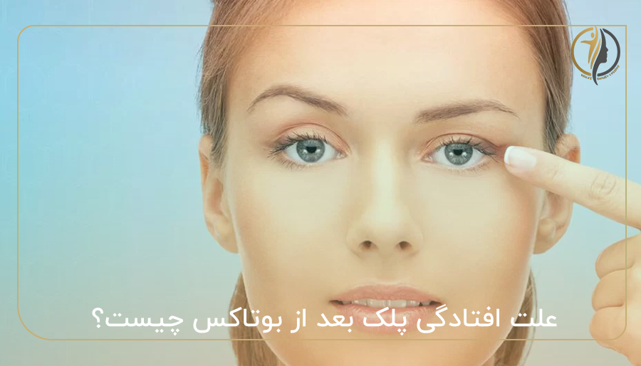 علت افتادگی پلک بعد از بوتاکس چیست؟