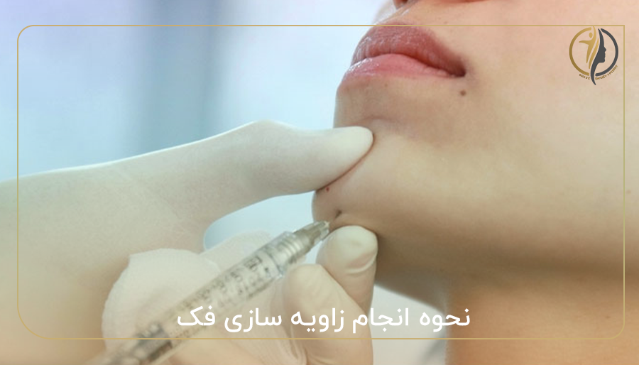 نحوه انجام زاویه سازی فک