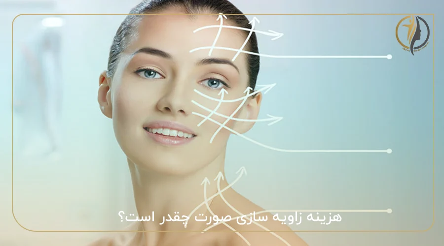 هزینه زاویه سازی صورت چقدر است؟