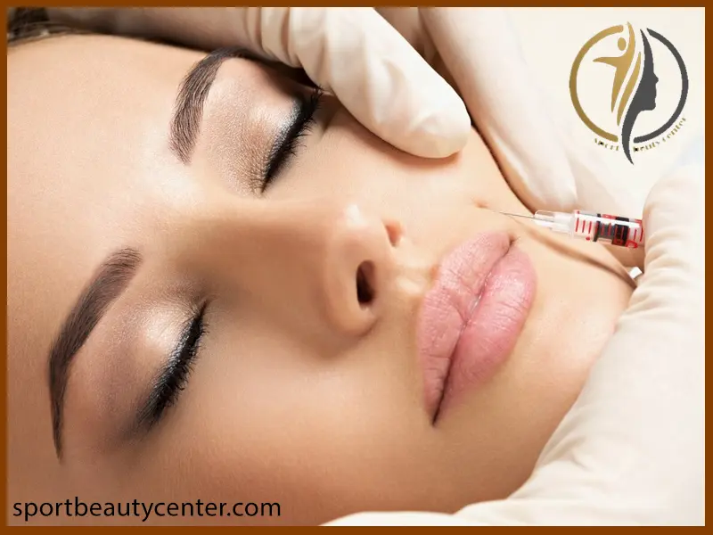 تزریق بوتاکس خط خنده ،معجزه بوتاکس خط خنده